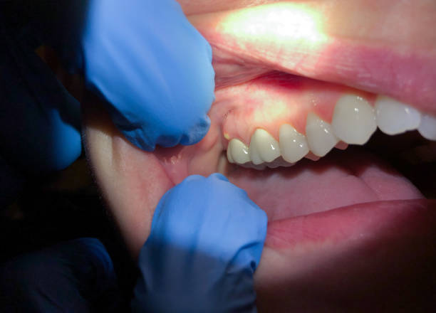Best Walk-In Emergency Dentist in Northville, NY